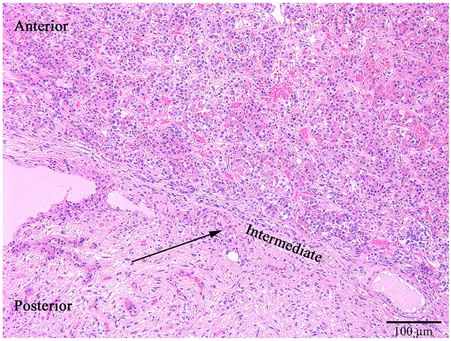 The anterior, intermediate (thin black arrow) and posterior lobes of the normal pituitary gland.