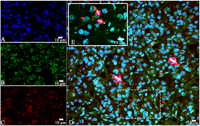 Laser Confocal Scanning Microscopy of the normal anterior pituitary.