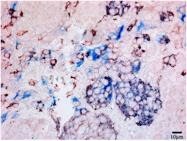 Double-staining immunohistochemistry of the normal anterior pituitary.