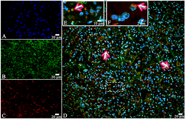 Laser Confocal Scanning Microscopy of the normal anterior pituitary.