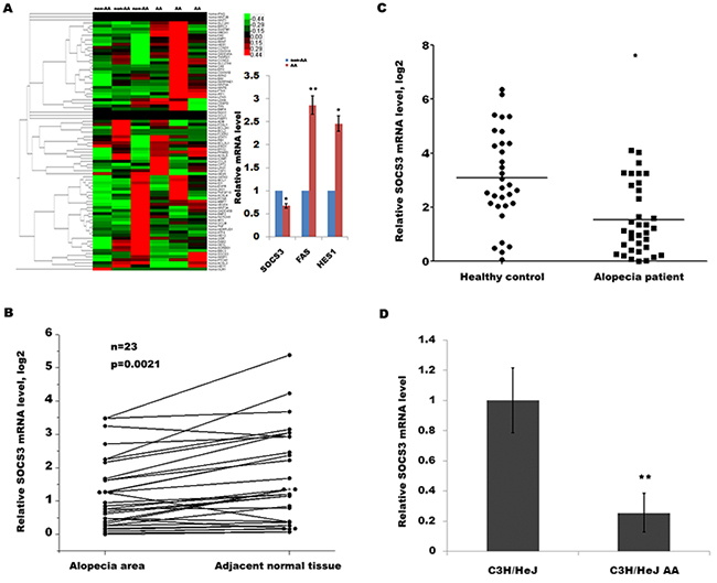 SOCS3 level is downregulated in human and mouse with AA.