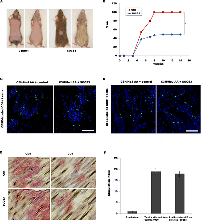 SOCS3 treatment markedly prevents onset of alopecia in AA skin-grafted C3H/HeJ mice.
