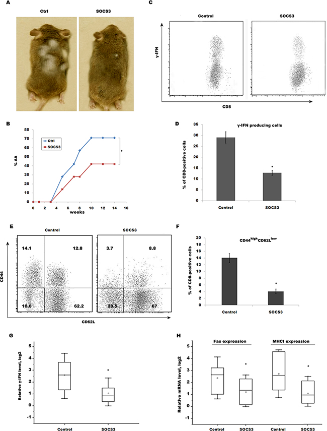 SOCS3 prevents AA induced by transfer of CD8+ T cells through inhibiting IFN-&#x03B3; signaling.