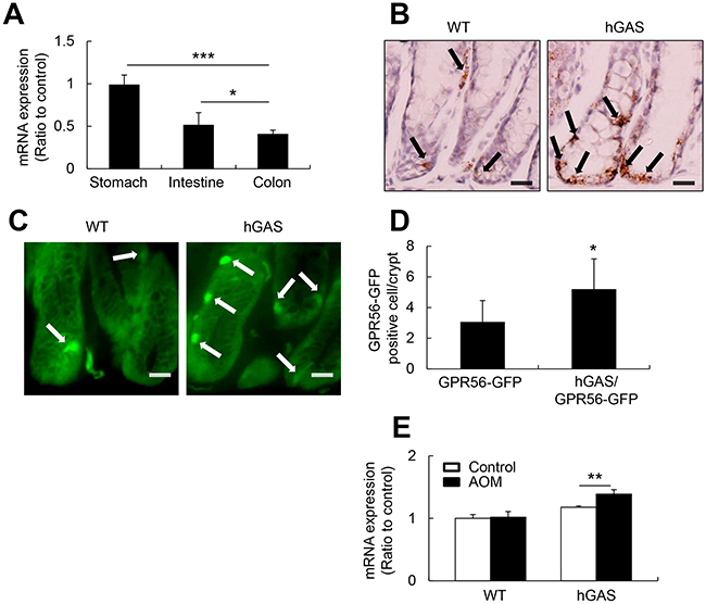 GPR56 expresses in the murine colonic mucosa and upregulates in the hGAS mice colon.