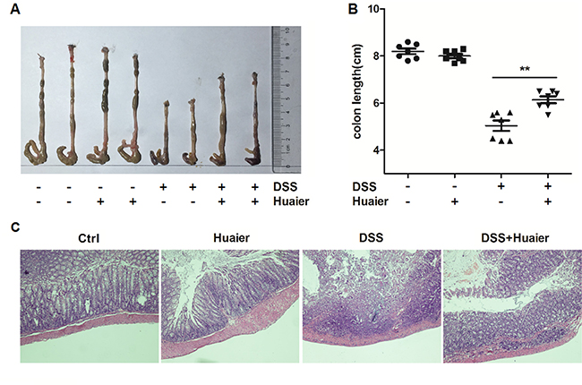 Huaier possesses a protective effect on mice with DSS-induced colitis.