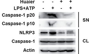 Huaier aqueous extract inhibits caspase-1 cleavage.