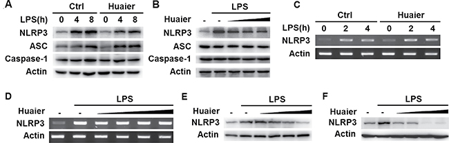 Huaier inhibits NLRP3 protein expression.