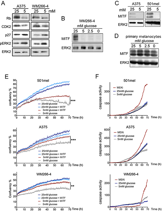 Glucose availability regulates MITF expression in melanoma cells.