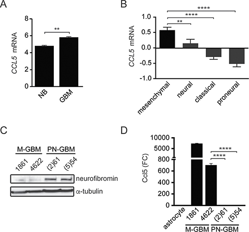 M-GBM express high levels of CCL5.