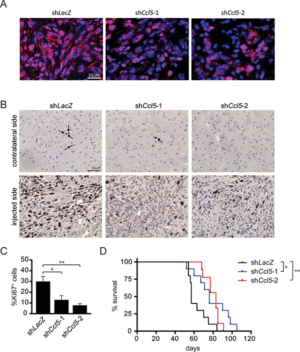 Ccl5 knockdown reduces M-GBM growth and prolongs mouse survival in vivo.