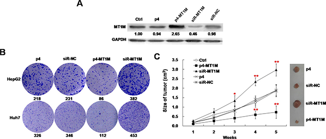 MT1M suppressed tumor growth in vitro and in vivo.
