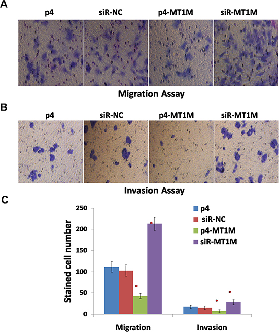 MT1M suppressed cell migration and invasion.