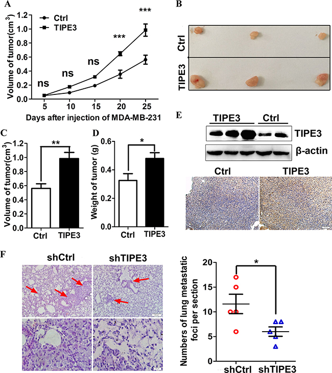 TIPE3 promotes tumorigenesis and metastasis of human breast ca