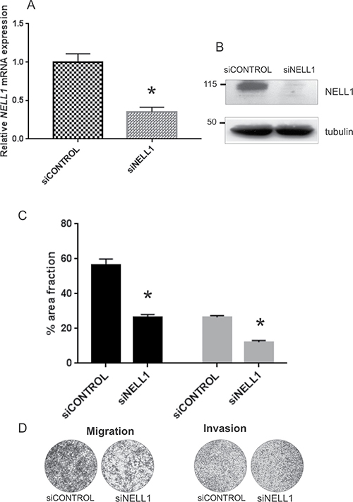 NELL1 involvement in migration of tumor cells.