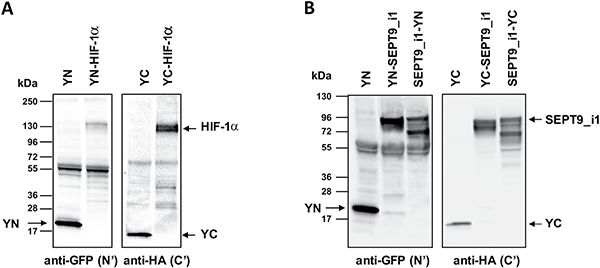 Expression of split-YFP HIF-1&#x03B1; and SEPT9_i1 chimeras.
