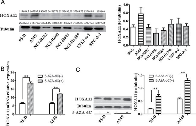 HOXA11 protein expression in lung cancer cell lines and effects of 5-Aza-dC on demethylation and re-expression of silenced HOXA11.