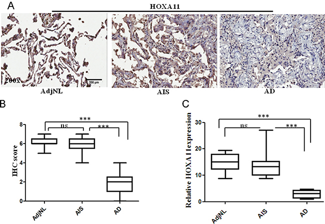 Immunohistochemical (IHC) staining of HOXA11 protein in lung tissues.