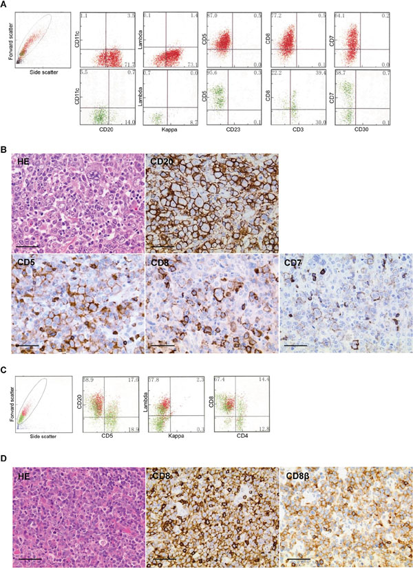 Morphological and immunophenotypic features of T-cell marker-positive diffuse large B-cell lymphomas.