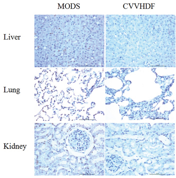 Pathological change of Liver, Lung and kidney in MODS group and CVVHDF group.