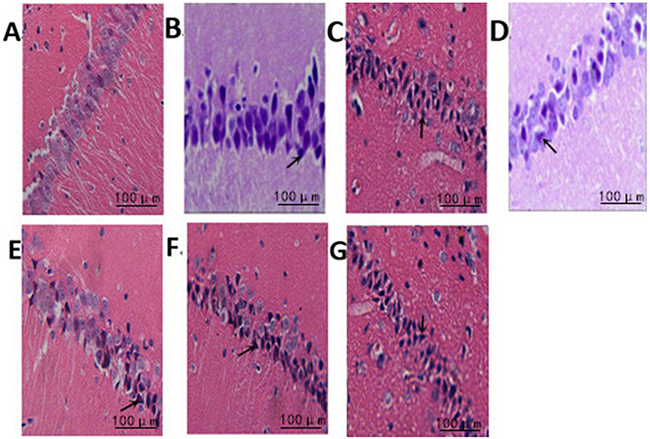 The effect of treadmill running on brain neurons of rats between the groups (400&#x00D7;).