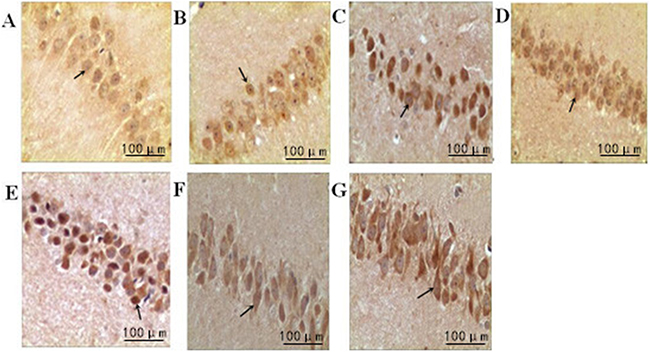 The effect of treadmill running on hippocampal expressions of cyclin A in each group (400&#x00D7;).