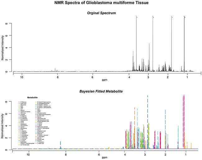 High resolutionNMR-Spectra of one patient including a raw spectra (upper panel) and fitted curves (lower panel).