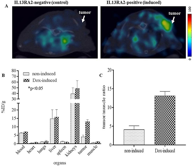 PET/CT of [64Cu]Pep-1L targeting IL13RA2 expressing tumors.