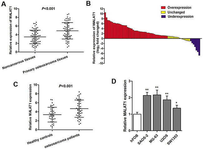 LncRNA MALAT1 is up-regulated in osteosarcoma specimens and cell lines.