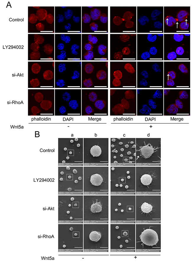 Effects of PI3K/Akt and RhoA on Wnt5a-induced actin polarization and pseudopodium formation.