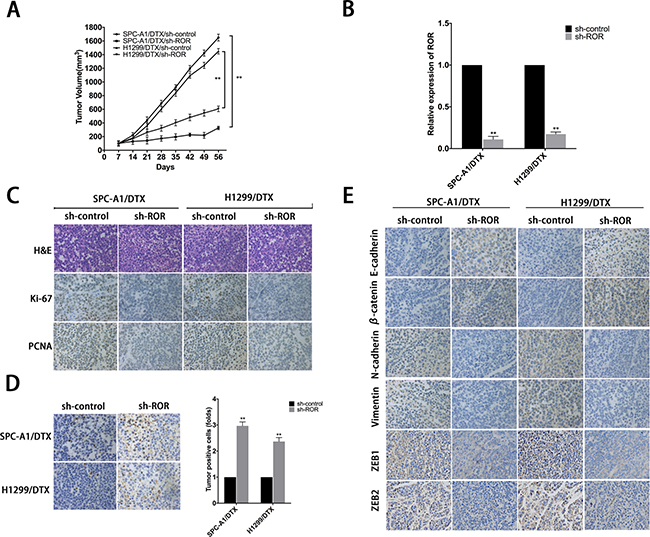 Effect of linc-ROR on chemoresistance and EMT of docetaxel-resistant LAD cells in vivo.