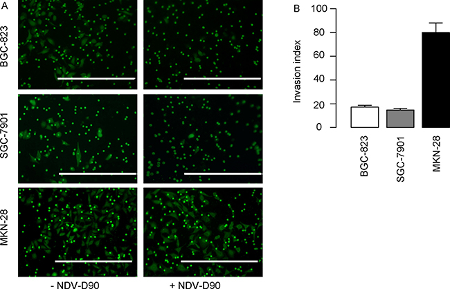 NDV-D90 reduces gastric cancer cell invasion in vitro.
