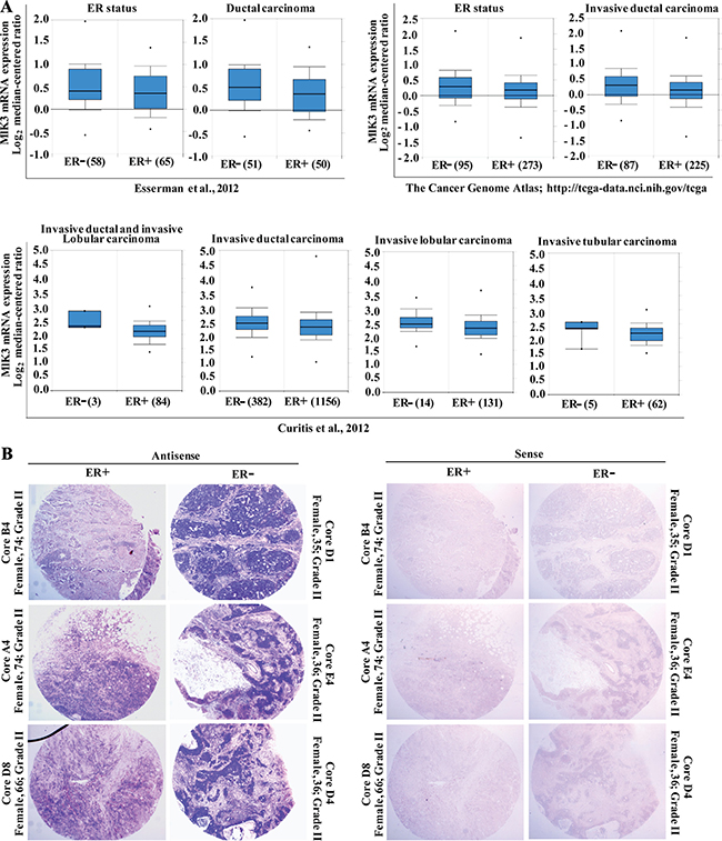 MLK3 expression is lower in estrogen receptor positive breast cancer tumors.