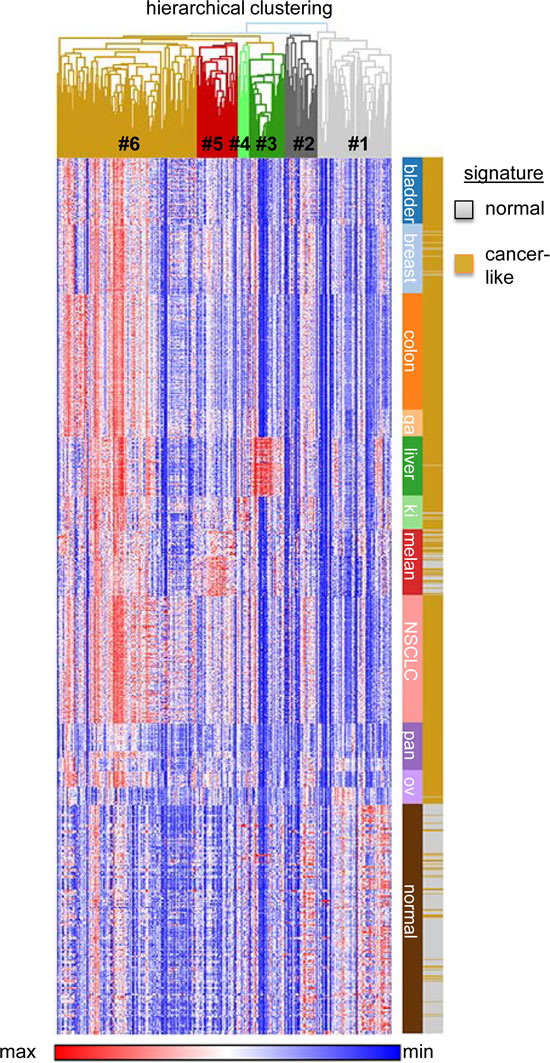 Gene expression patterns of 285 oxidative stress genes in 353 normal tissues and various carcinomas (total n=994, 10 different entities).