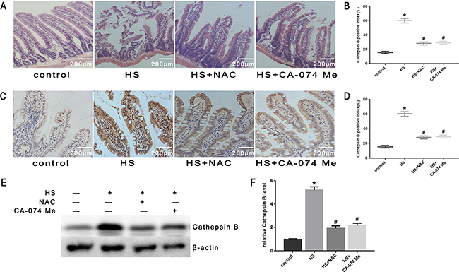 Effect of antioxidant NAC and cathepsin B inhibitor CA-074 Me in intestinal tissue injury and cathepsin B release in vivo.