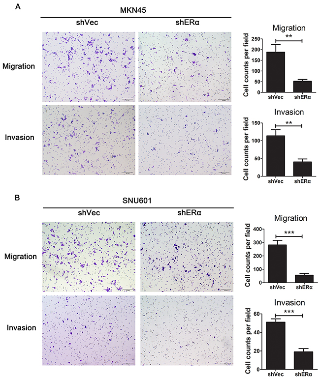 Downregulation of ER&#x03B1; suppressed the migration and invasion of GC cells in vitro.