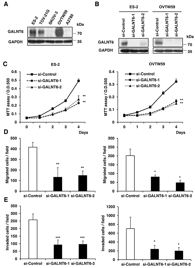 Effects of GALNT6 knockdown on malignant phenotypes in ovarian cancer cells.