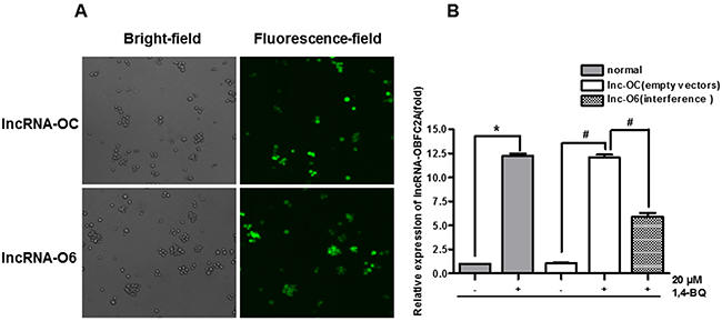 Construct and verify the lentiviral interference model of lncRNA-OBFC2A.