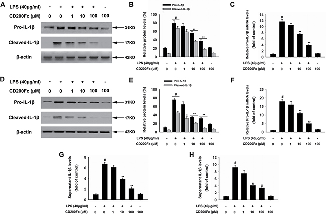 Effects of CD200Fc on production and activation of IL-1&#x03B2; in LPS-stimulated SiHa cells and Caski cells.