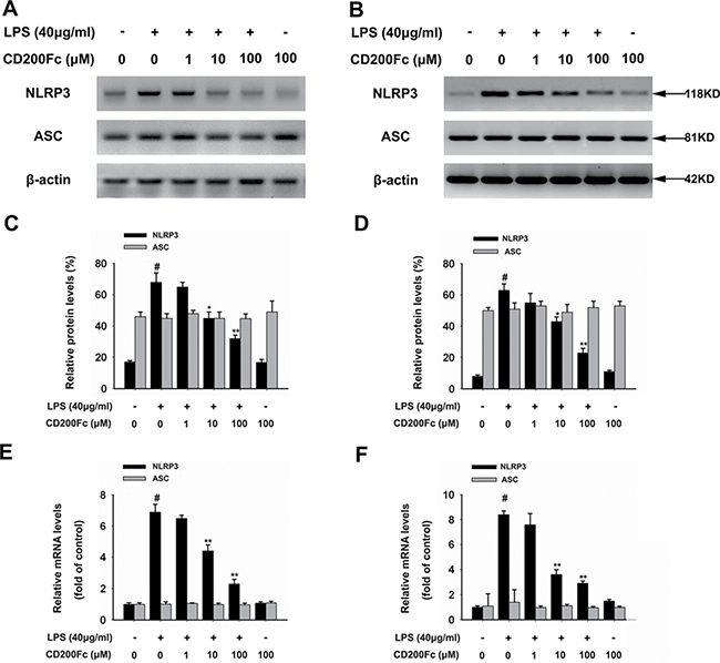 Effects of CD200Fc on the expression of NLRP3 inflammasome components in LPS-stimulated SiHa cells and Caski cells.