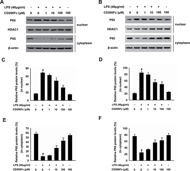 Effects of CD200Fc on the translocation of P65 from cytoplasm to nucleus in LPS-induced SiHa cells and Caski cells.