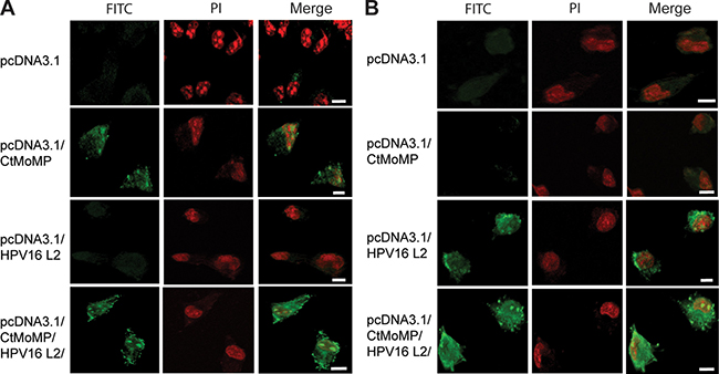 Confocal microscope imaging confirmed the expression of Ct MOMP and HPV16L2 in COS-7 cells after transfection.