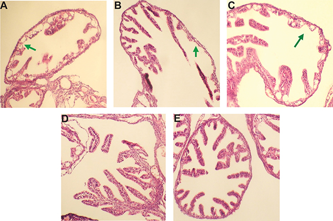 pcDNA3.1/Ct MOMP multi-epitope/HPV16L2 reduced mouse genital tract tissue pathologies.