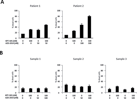 Cytotoxic effects of KPT-185 and AZD-2014 combination in primary MCL cells and not in normal hematopoietic stem cells.