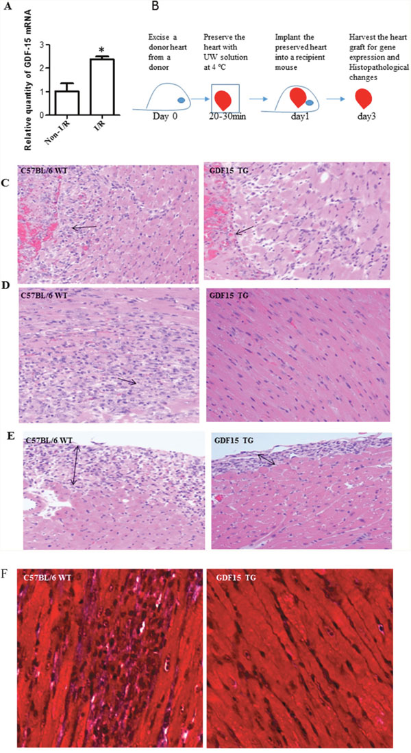 GDF15 protects hearts from I/R injury in heart transplantation.