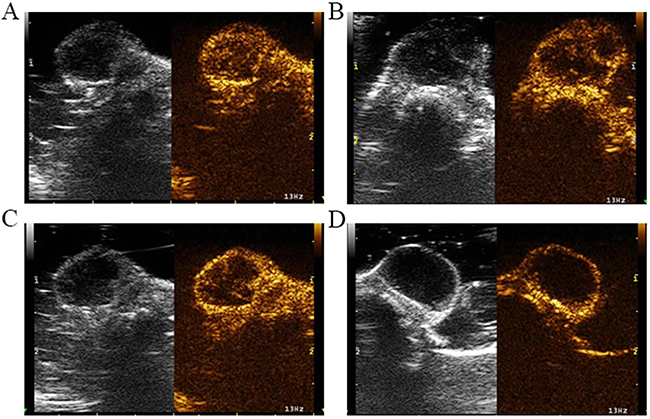 Serial CEUS images before and after irradiation.
