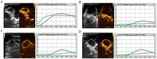 CEUS image and DCE-US time-intensity curves of one mouse in Group B at different times before and after irradiation.
