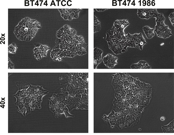 Transmitted light microscopy of BT474 cells.