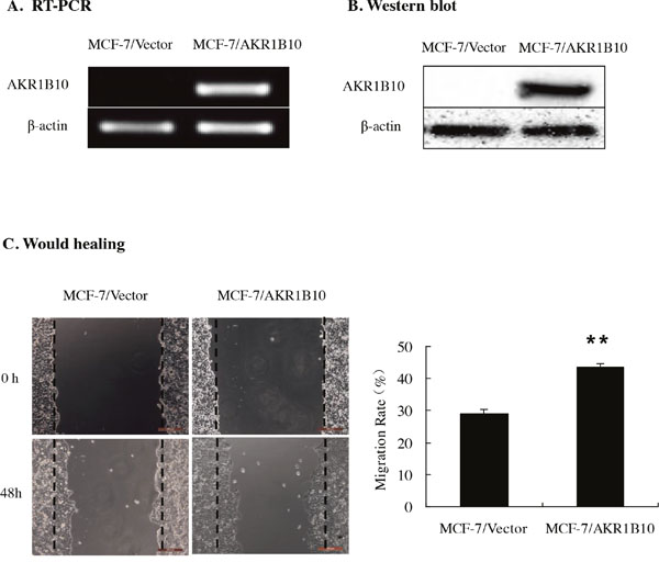 Effect of AKR1B10 on wound healing ability of MCF-7 cells.