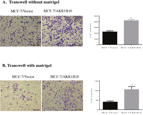 Effects of AKR1B10 on transwell migration and invasion abilities of MCF-7 cells.