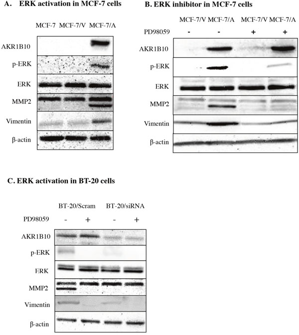 AKR1B10 promotes ERK signaling in MCF-7 cells and BT-20 cells.